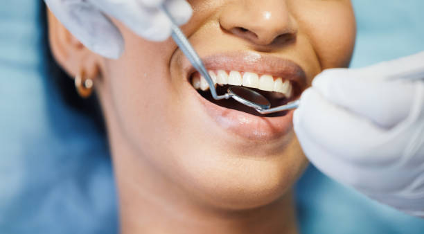 Best Dentist for Tooth Abscess  in Leadington, MO